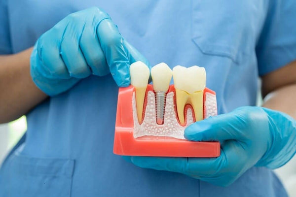 Endodontija – šaknų kanalų gydymas